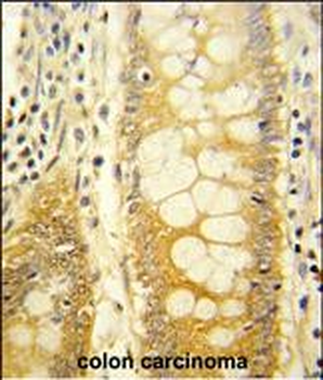 LGALS2 Antibody (Center)