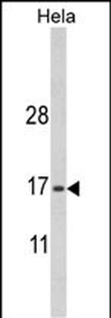 MPV17 Antibody (N-term)