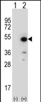 PPID Antibody (N-term)