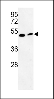 PISD Antibody (Center)