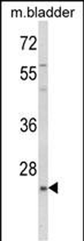 KLF16 Antibody (Center)