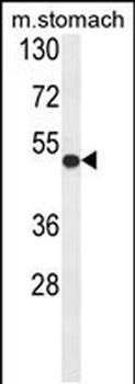 FERMT1 Antibody (Center)