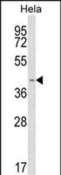 INSIG1 Antibody (N-term)
