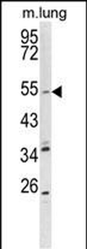 KCNQ1 Antibody (Center)