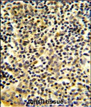 BPI Antibody (Center)