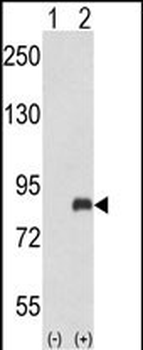 ADRBK2 Antibody (N-term)