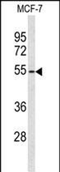 ADAMDEC1 Antibody (N-term)