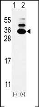 KXD1 Antibody (Center)