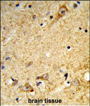 MALD2 Antibody (C-term)
