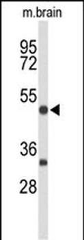 MEF2A Antibody (Center)