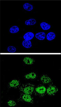 MEF2A Antibody (Center)