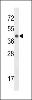 CENPK Antibody (C-term)