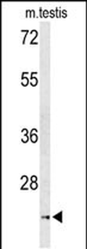 UNC119 Antibody (Center)