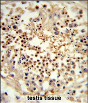 UNC119 Antibody (Center)