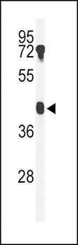 B4GALT2 Antibody (C-term)
