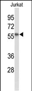 SACM1L Antibody (C-term)