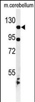 KIF6 Antibody (N-term)