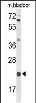 DGCR6 Antibody (Center)