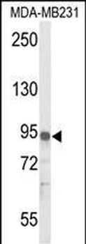 IL17RD Antibody (N-term)