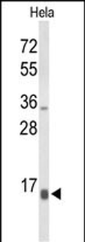 NPW Antibody (C-term)