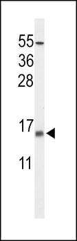 KCE1L Antibody (Center)