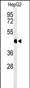 HFE2 Antibody (C-term)