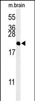 NP1L5 Antibody (center)
