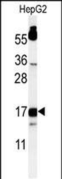 TYROBP Antibody (C-term)