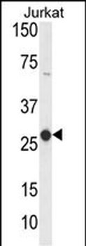 CD160 Antibody (Center)