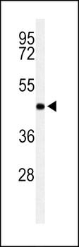 RPR1B Antibody (C-term)