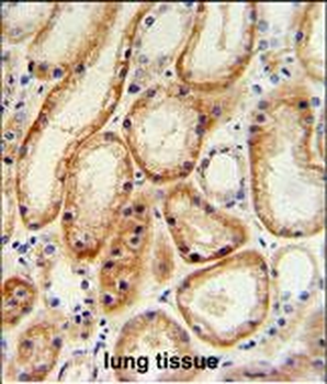 GALNT5 Antibody (N-term)