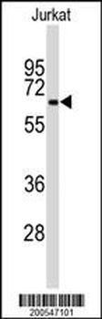 BECN1 Antibody (Ascites)