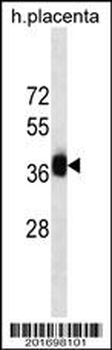 GBX2 Antibody (Center)(Ascites)