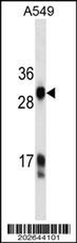 HKLK3 Antibody (C234)
