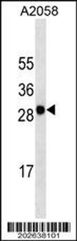 MART-1/Melan-A Antibody (C-term) (Ascites)