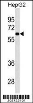 CD138 Antibody (C-term) (Ascites)