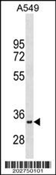 MyoD1 Antibody (N-term) (Ascites)