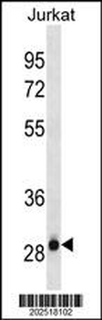 HAGH Antibody (C-term) (Ascites)