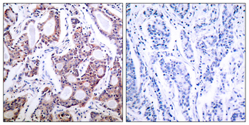 NF-KB p100 Antibody (Ab-869)
