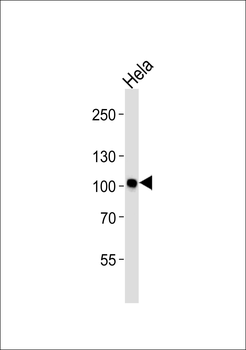 NF-KB p100 Antibody (Ab-869)