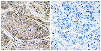 PLA2G4E Antibody
