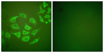 MMP-10 Antibody