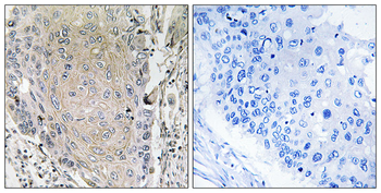 CBLN3 Antibody