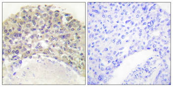 Shc (Phospho-Tyr349) Antibody