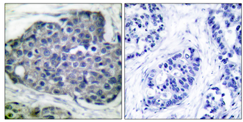 Acetyl-CoA Carboxylase (Phospho-Ser80) Antibody