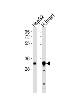 HCCS Antibody