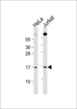 UBE2A/B Antibody