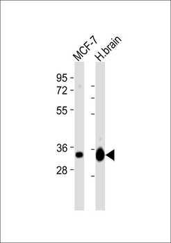 EB3 Antibody