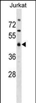 MAPKAPK2 Antibody (N-term)