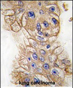 Mouse TLR3 Antibody (N-term)